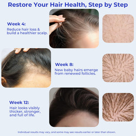 Eoiroa thinning-area coverage with precision roll-on for on-the-go use.