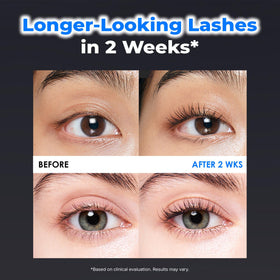 EPAIS lash and brow serum applied along the hairline