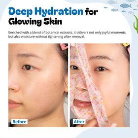 Epielle narwhal design mask for soothing moisture and whimsy