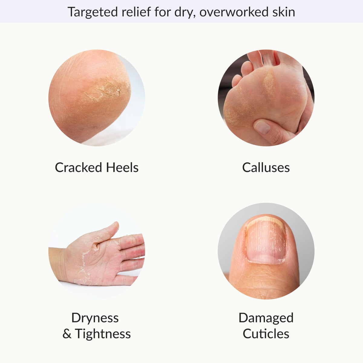 Epielle foot mask application scene highlighting moisture from heel to toe.