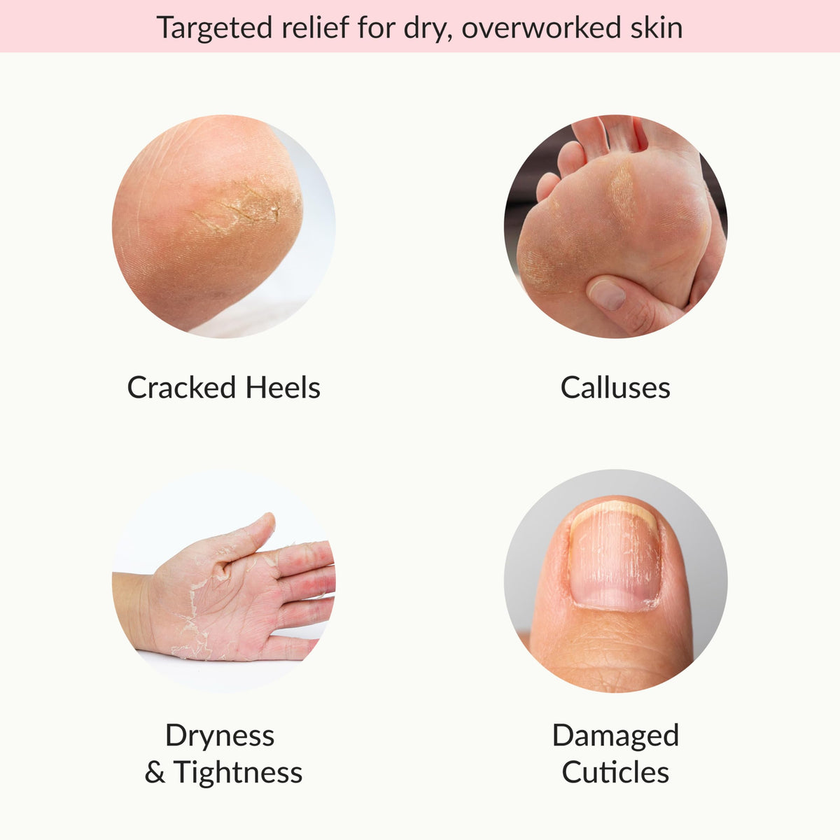 Epielle Moisturizing Socks close-up highlighting soft, hydrated feet.