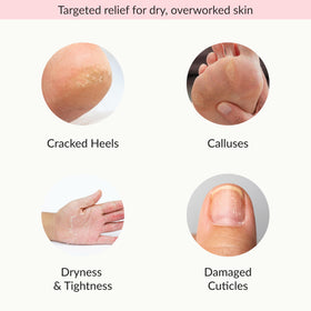 Epielle Moisturizing Socks close-up highlighting soft, hydrated feet.