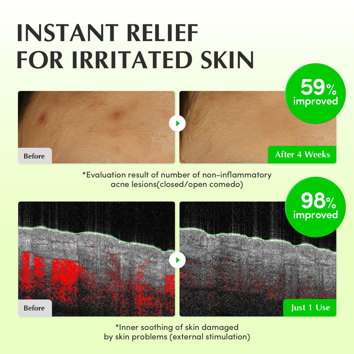 EQQUALBERRY Green Tea extract in Calming Toner highlights sebum control.