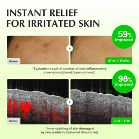 EQQUALBERRY Green Tea extract in Calming Toner highlights sebum control.
