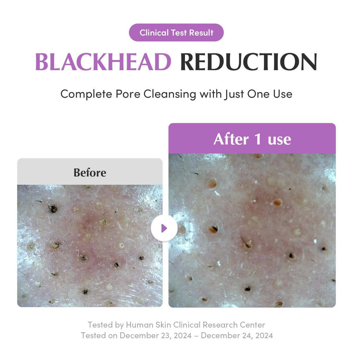 EQQUALBERRY Korean mud clay close-up highlights cleansing action on pores.