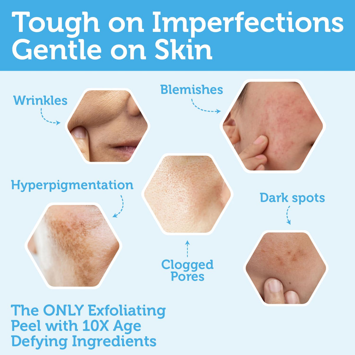 Era Organics Glycolic Acid Peel close-up texture highlighting active enzymes.