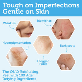 Era Organics Glycolic Acid Peel close-up texture highlighting active enzymes.
