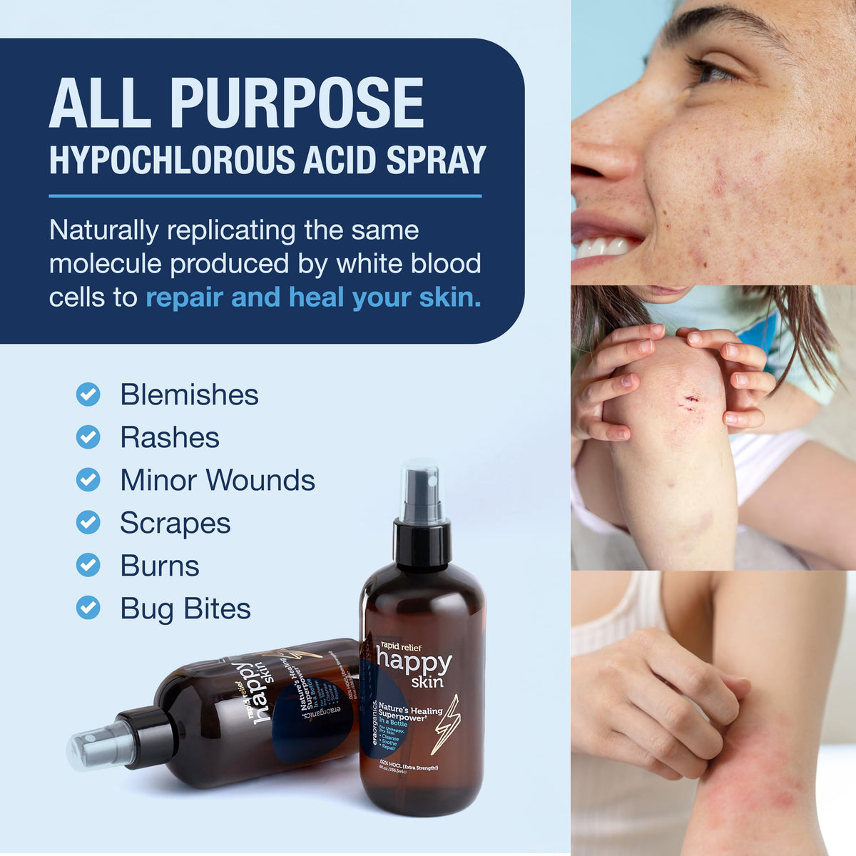 Era Organics Happy Skin HOCl toner label closeup highlighting clean, hypoallergenic formula