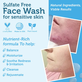 Era Organics Manuka Honey Face Wash hyaluronic-acid focus promotes balanced hydration