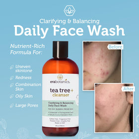 Era Organics Purifying Tea Tree Face Wash fragrance-free—gentle, irritation-free daily use.