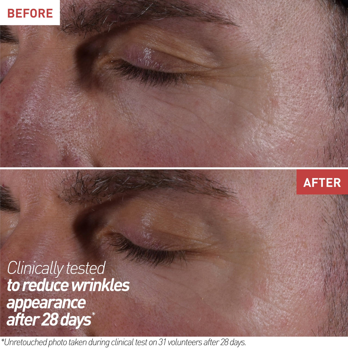 Erborian Skin Therapy Eye Cream hydrating gel provides lasting moisture.