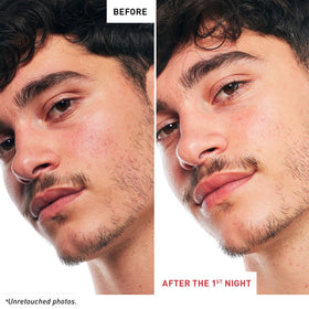 Erborian Skin Therapy Hyaluronic Acid drops emphasize moisture boost.