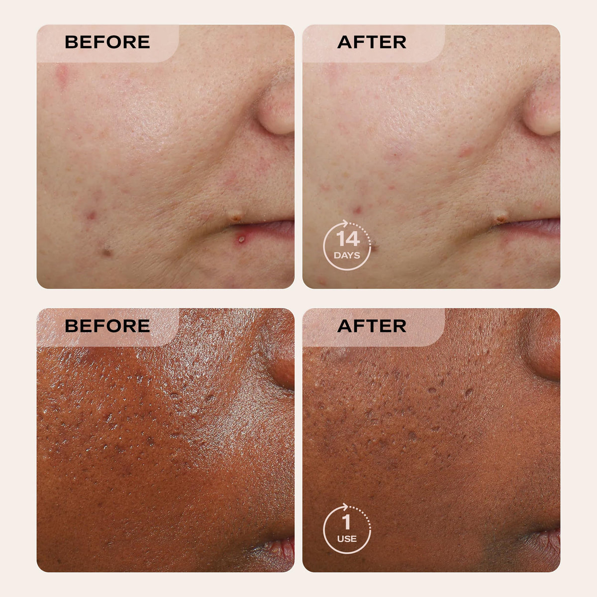 Gentle exfoliation texture of Erno Laszlo Sea Mud bar