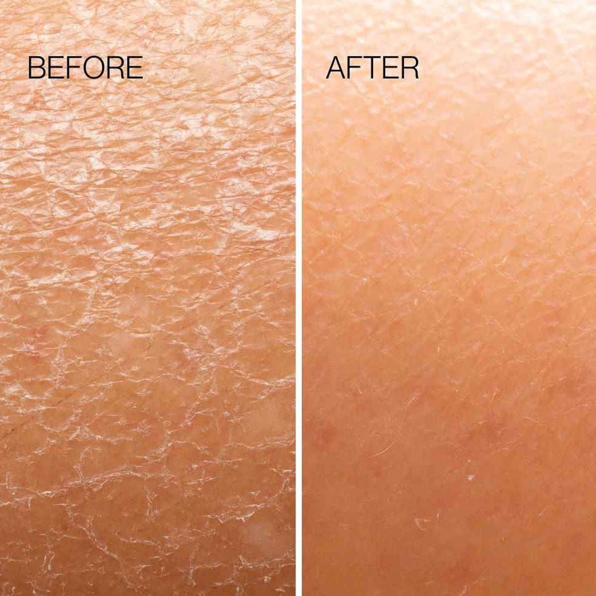 ESKER Body Plane promotes mild lymphatic drainage for subtle puffiness reduction.