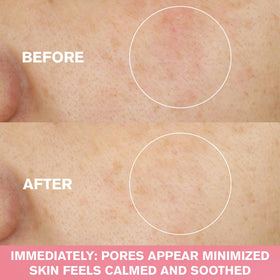 Application view of Nutritious wash for pore refinement.