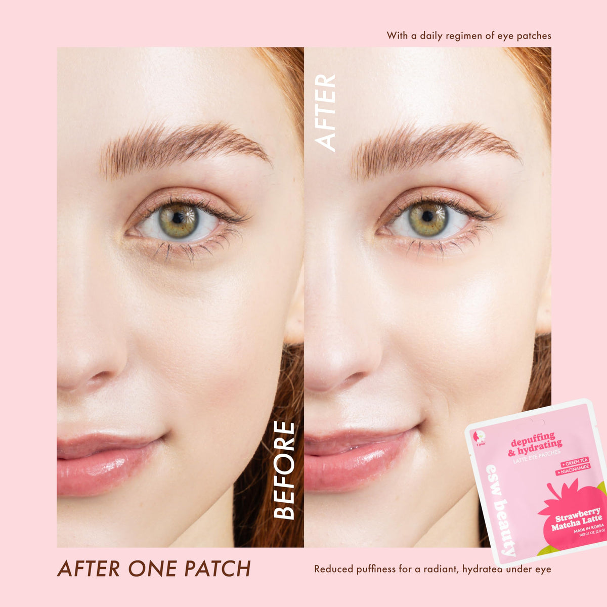 ESW Beauty Strawberry Matcha Latte Patches vegan hydrogel with niacinamide and hyaluronic acid.
