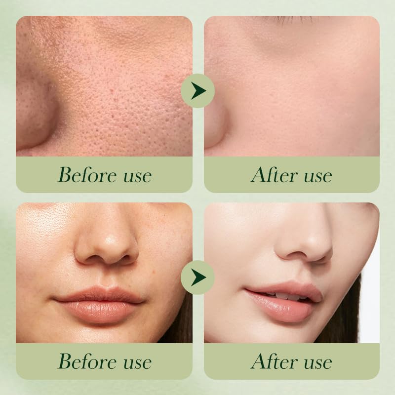 Etuanxi avocado toner bottle suggesting refreshing skin balance.