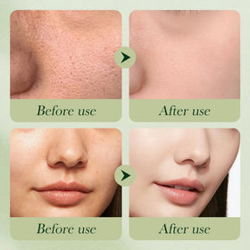 Etuanxi avocado toner bottle suggesting refreshing skin balance.