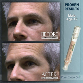 EUZEN Clean skin prep scene before applying the cream.
