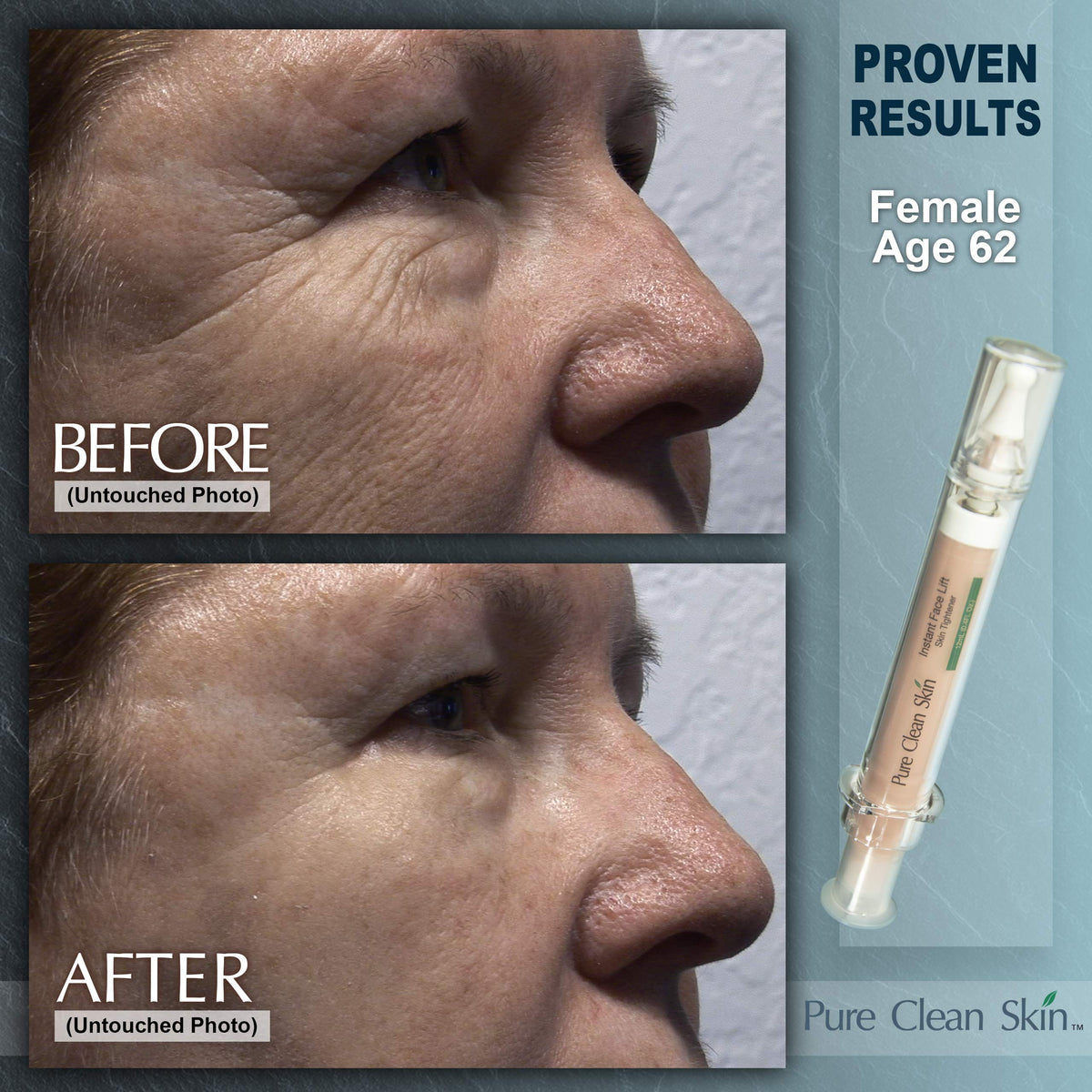 EUZEN Cream texture close-up reveals smooth, easy absorption.