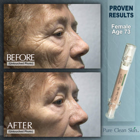 EUZEN Close-up highlights smoothing of fine lines for a polished look.