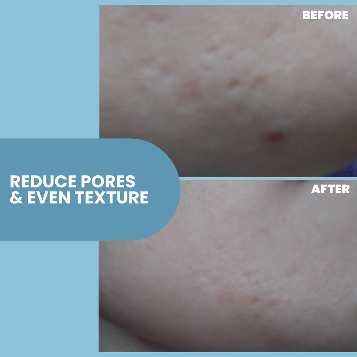 Eva Naturals peptides for collagen support label hints at improved elasticity potential