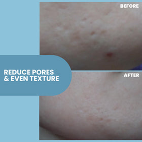 Eva Naturals peptides for collagen support label hints at improved elasticity potential