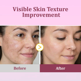 Applying Eveloria Turmeric & Kojic Toner Pad on the face during routine