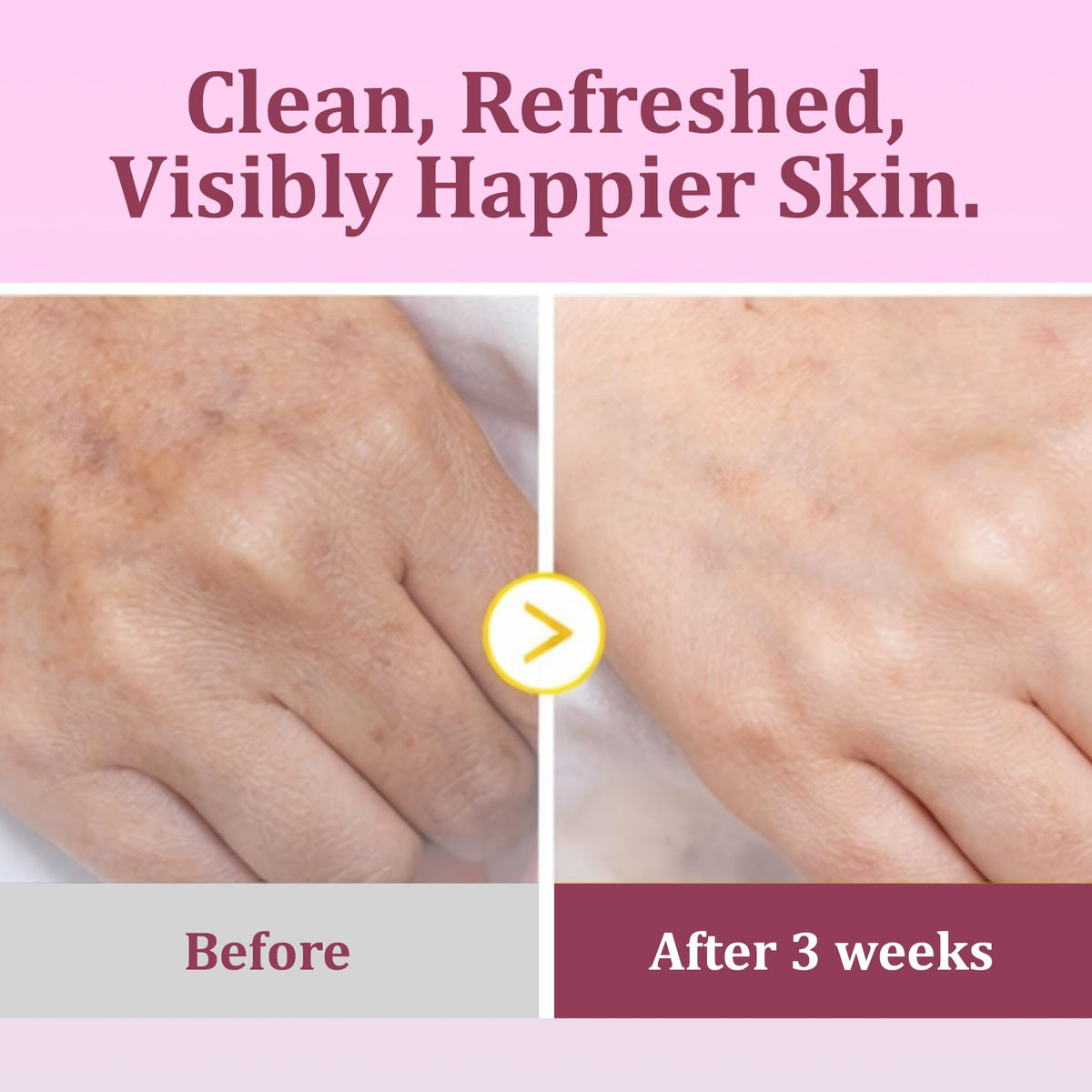 Ingredients; kojic acid, turmeric and vitamin C in Eveloria pads