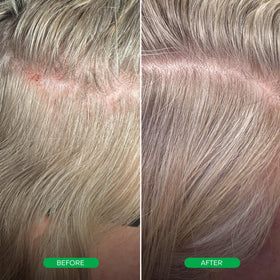Everist EverBoost close-up of peptides highlighting tri peptide action for fuller strands