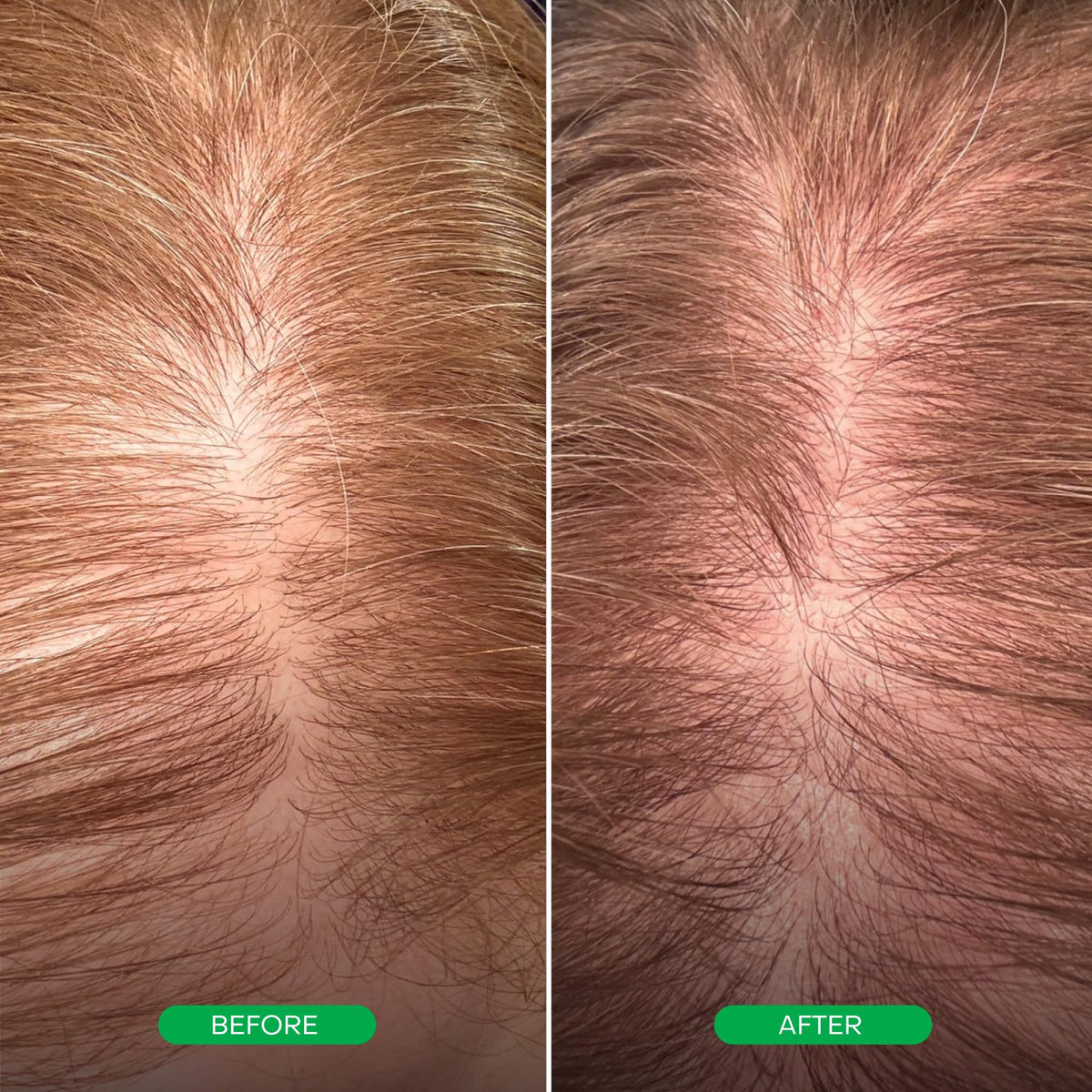 Everist EverBoost scalp application on damp hair demonstrating even distribution