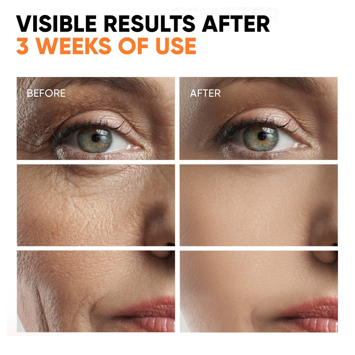 EVERYOUTH Vitamin C Serum ingredients niacinamide closeup highlights pore refinement.