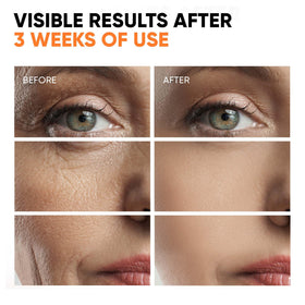 EVERYOUTH Vitamin C Serum ingredients niacinamide closeup highlights pore refinement.