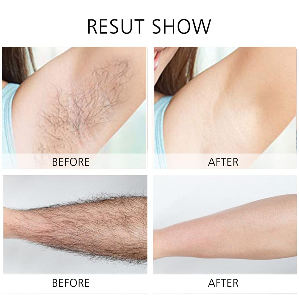 EwaCCen wet and dry shaving with replacement head for versatile grooming
