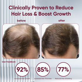 EXCALVO Shampoo coconut oil ingredient near bottle indicates deep nourishment
