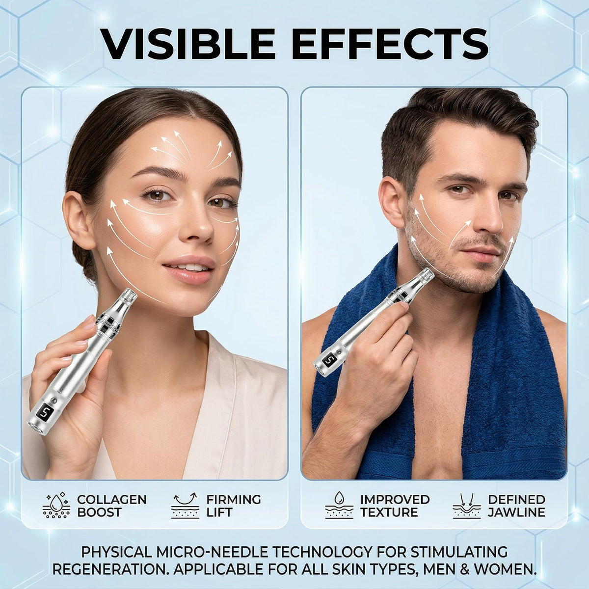 Exfyery Derma Roller suitable for both women and men at home.
