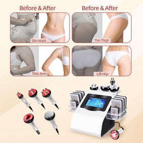 Expbom Body Machine compact design with multiple handles in white for versatile use.