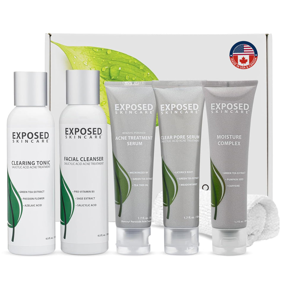 Exposed Skin Care acne kit box shown for starting a clear-skin routine.