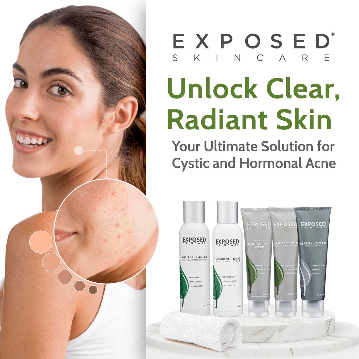 Exposed Skin Care kit used by teens and adults for daily routine