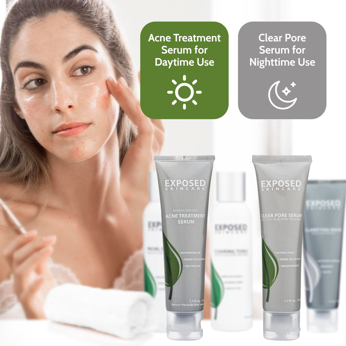 Exposed Skin Care acne kit packaging shows a complete routine