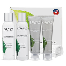 Exposed Skin Care Basic Acne Treatment Kit bottle close-up for an easy daily regimen