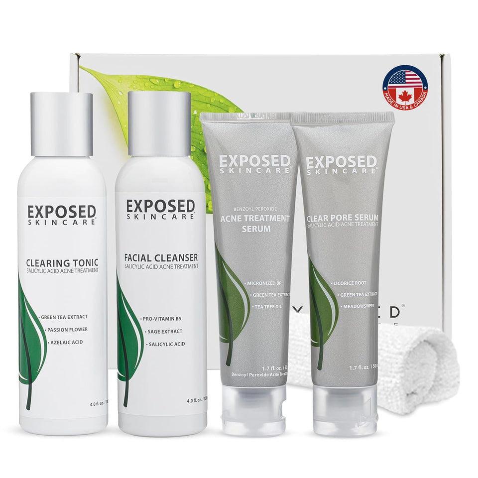 Exposed Skin Care Basic Acne Treatment Kit bottle close-up for an easy daily regimen