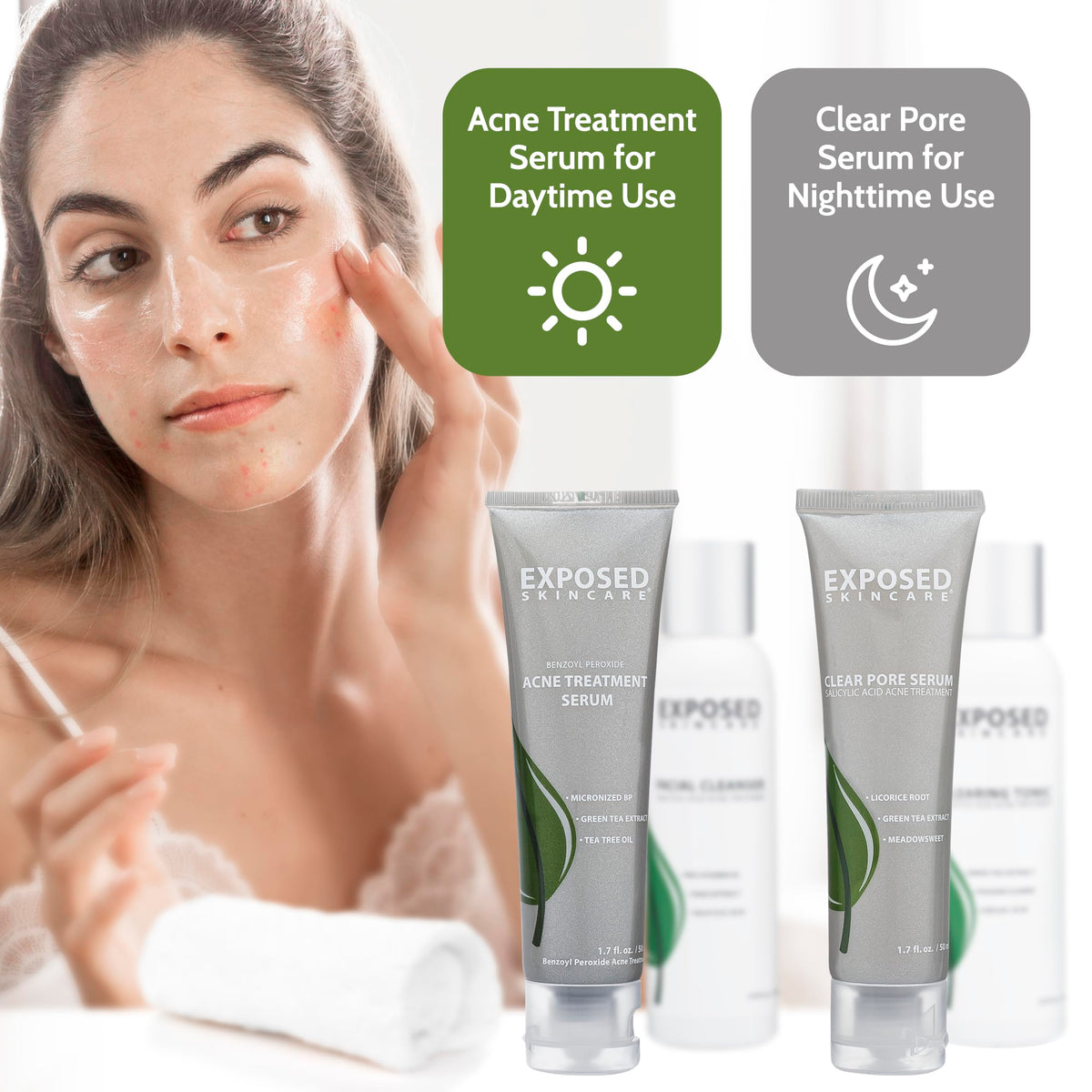 Exposed Skin Care Basic Acne Treatment Kit benefits concept for potential improvements