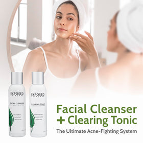 Exposed Skin Care Basic Acne Treatment Kit spot treatment use on blemishes