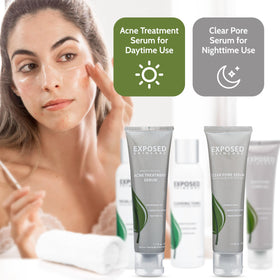 Exposed Skin Care daily routine card supports a structured acne care plan.