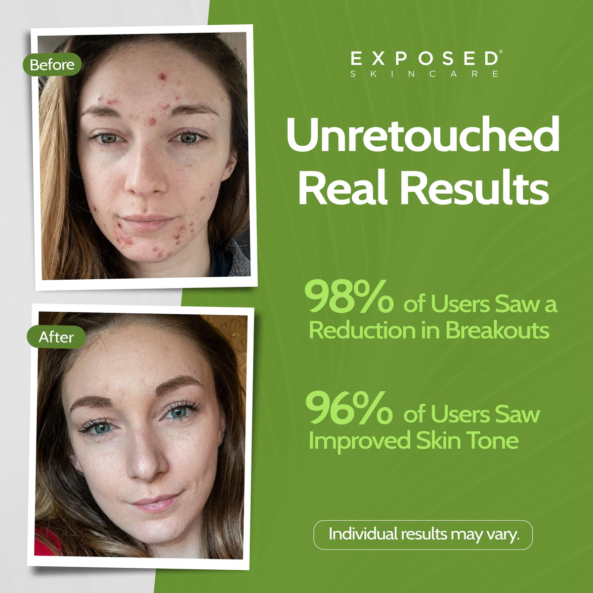Exposed Skin Care Moisture Complex close-up of green tea and caffeine ingredients