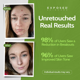 Exposed Skin Care Moisture Complex close-up of green tea and caffeine ingredients
