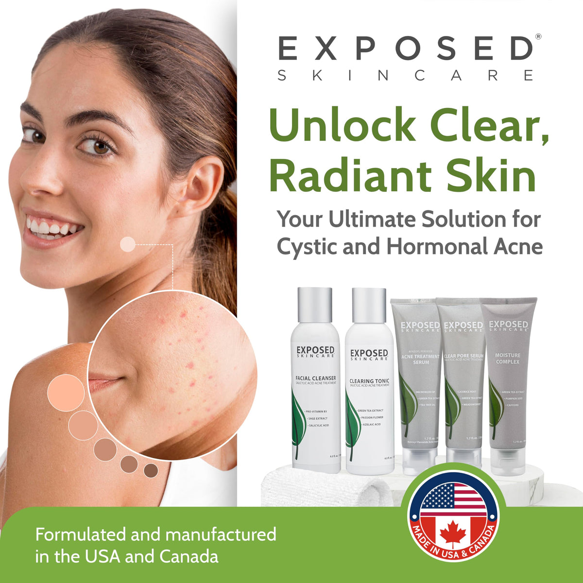 Exposed Skin Care spot-treatment tiny bottle focuses blemishes effectively.