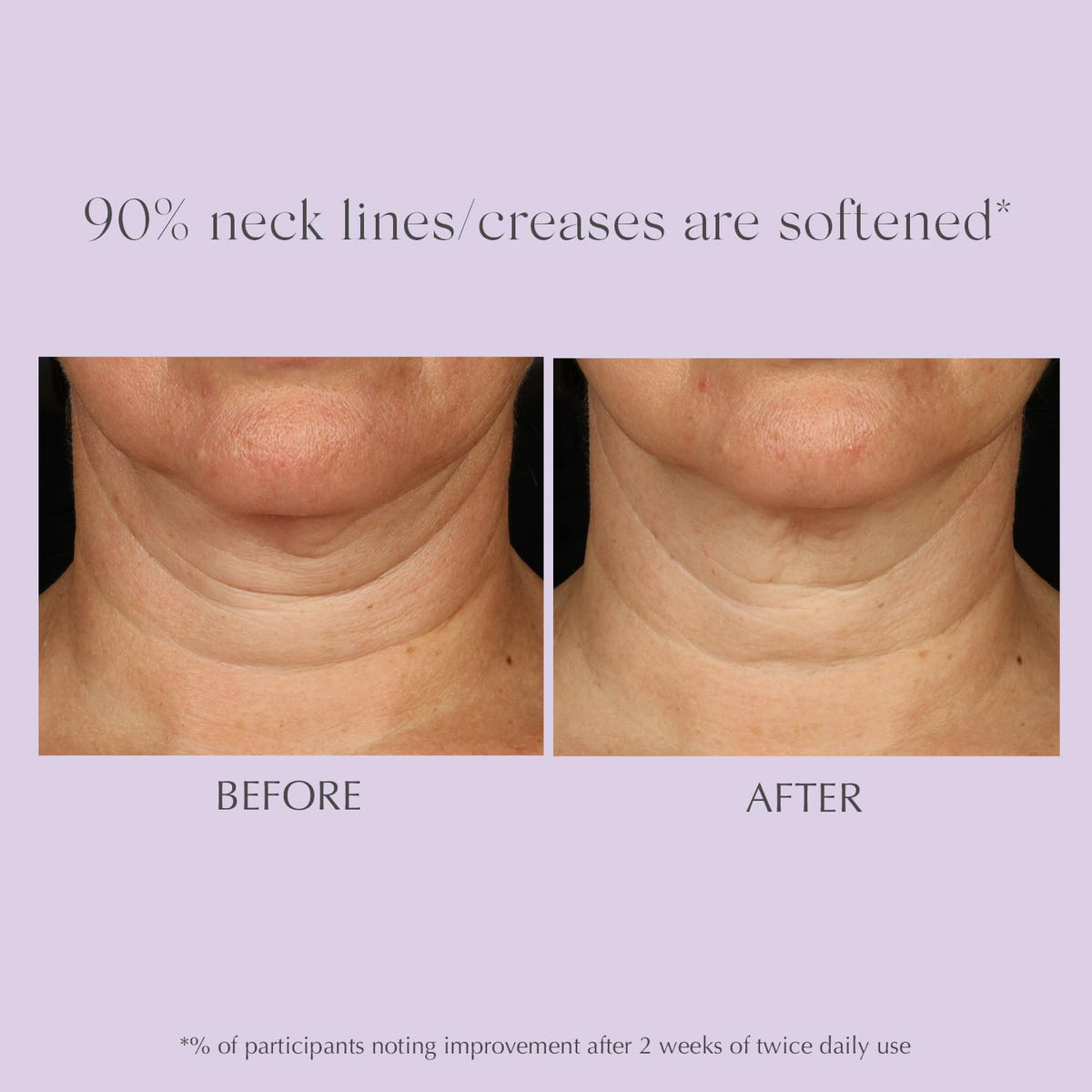 EXUVIANCE Age Reverse Apple Stem Cell Extract supports renewal on the décolletage