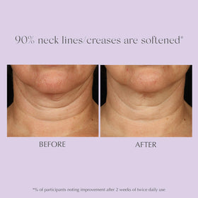 EXUVIANCE Age Reverse Apple Stem Cell Extract supports renewal on the décolletage